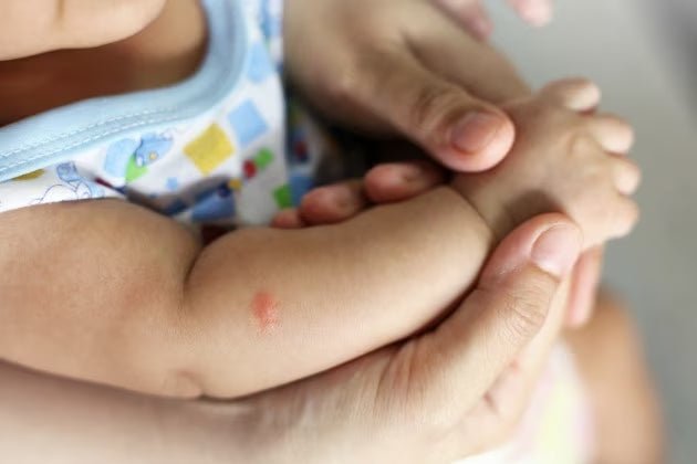 Zanzare: Consigli per Bambini e Neonati - Noi da piccoli